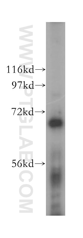 Western Blot (WB) analysis of human placenta tissue using PGCP Polyclonal antibody (16601-1-AP)