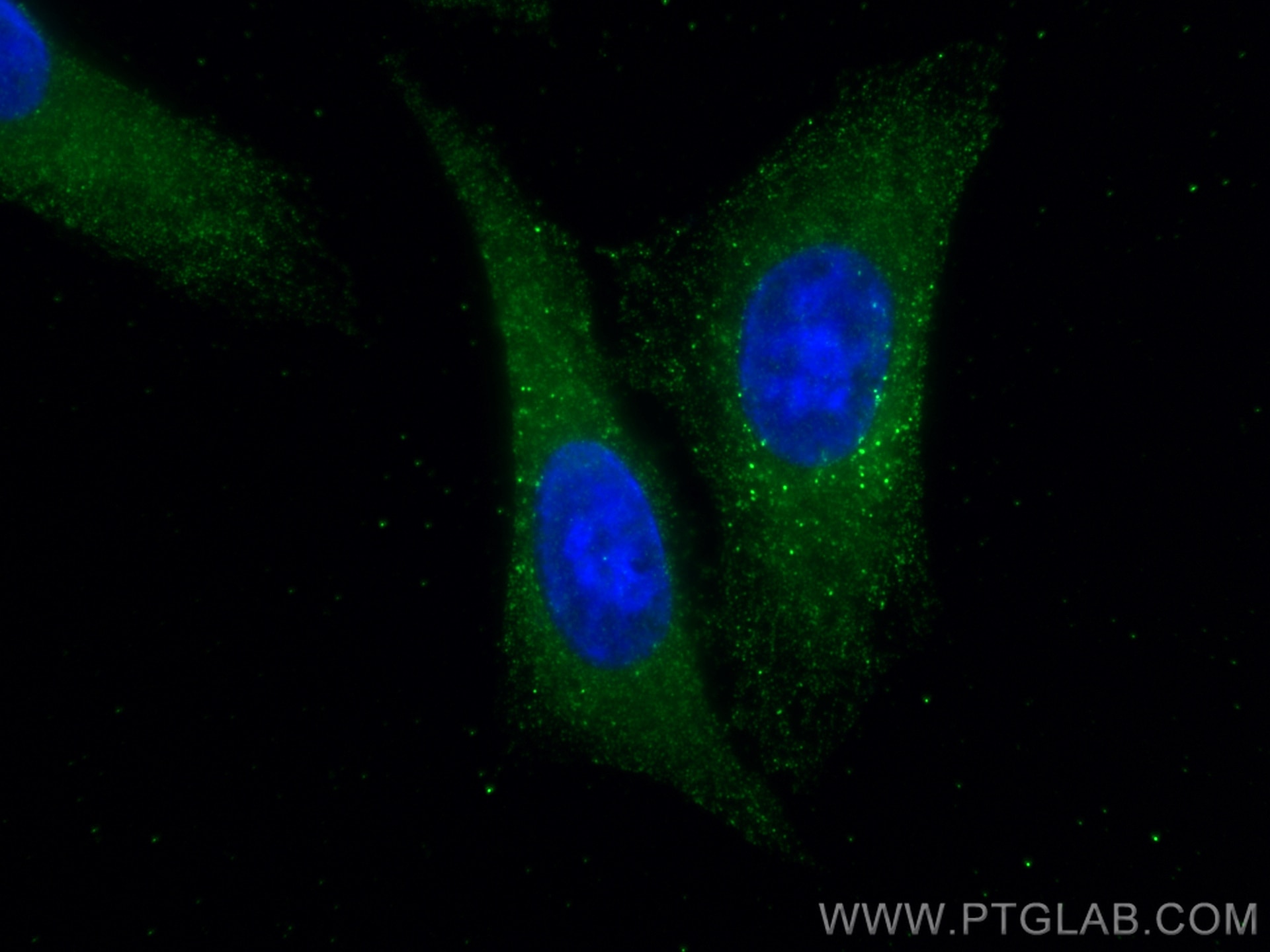 Immunofluorescence (IF) / fluorescent staining of HepG2 cells using PGD Monoclonal antibody (67916-1-Ig)