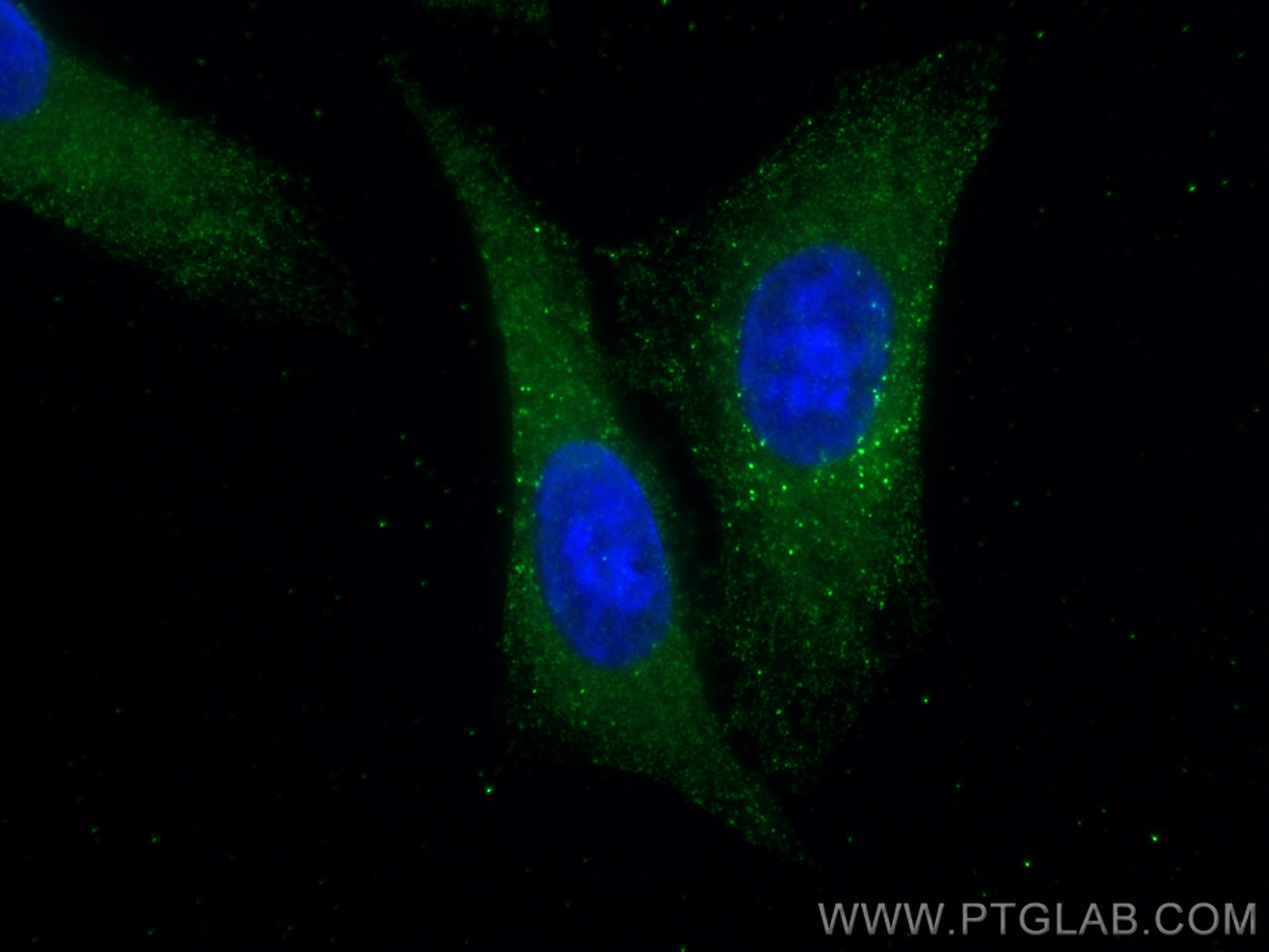 IF Staining of HepG2 using 67916-1-Ig