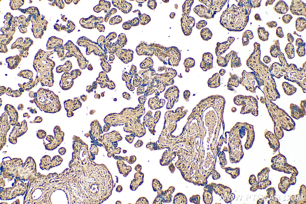 Immunohistochemistry (IHC) staining of human placenta tissue using HPGDS Polyclonal antibody (22522-1-AP)