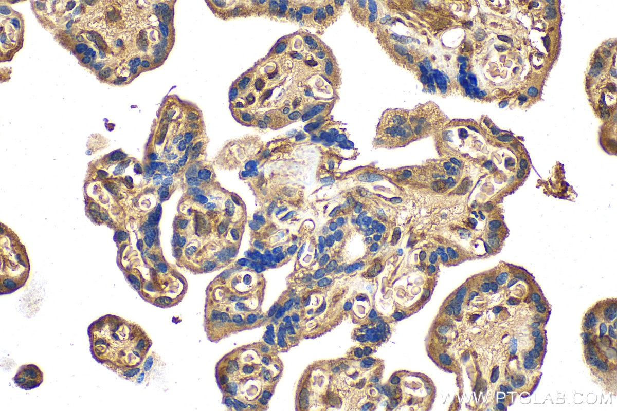 Immunohistochemistry (IHC) staining of human placenta tissue using HPGDS Polyclonal antibody (22522-1-AP)