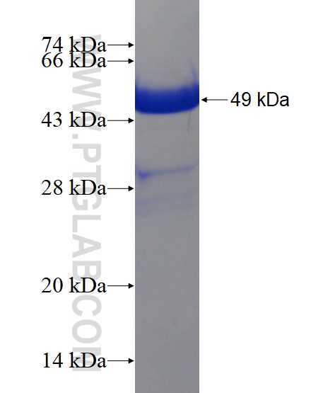 PGDS fusion protein Ag18290 SDS-PAGE