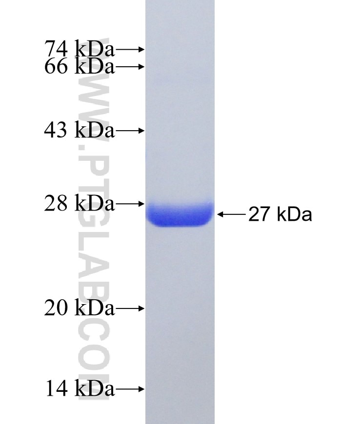PGDS fusion protein Ag18339 SDS-PAGE