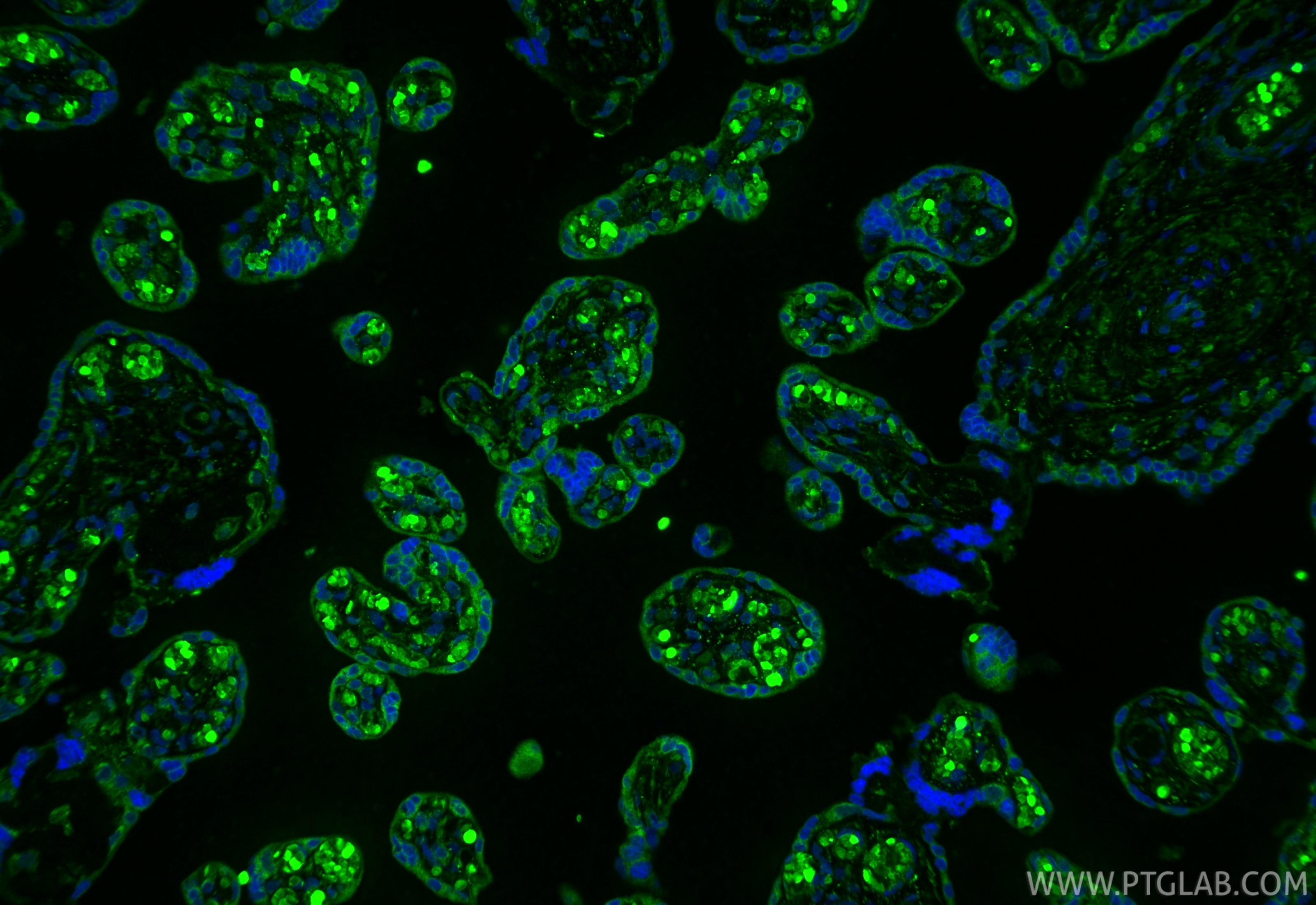 IF Staining of human placenta using 10642-1-AP Immunofluorescence (IF) / fluorescent staining of human placenta tissue using PGF/PLGF Polyclonal antibody (10642-1-AP)