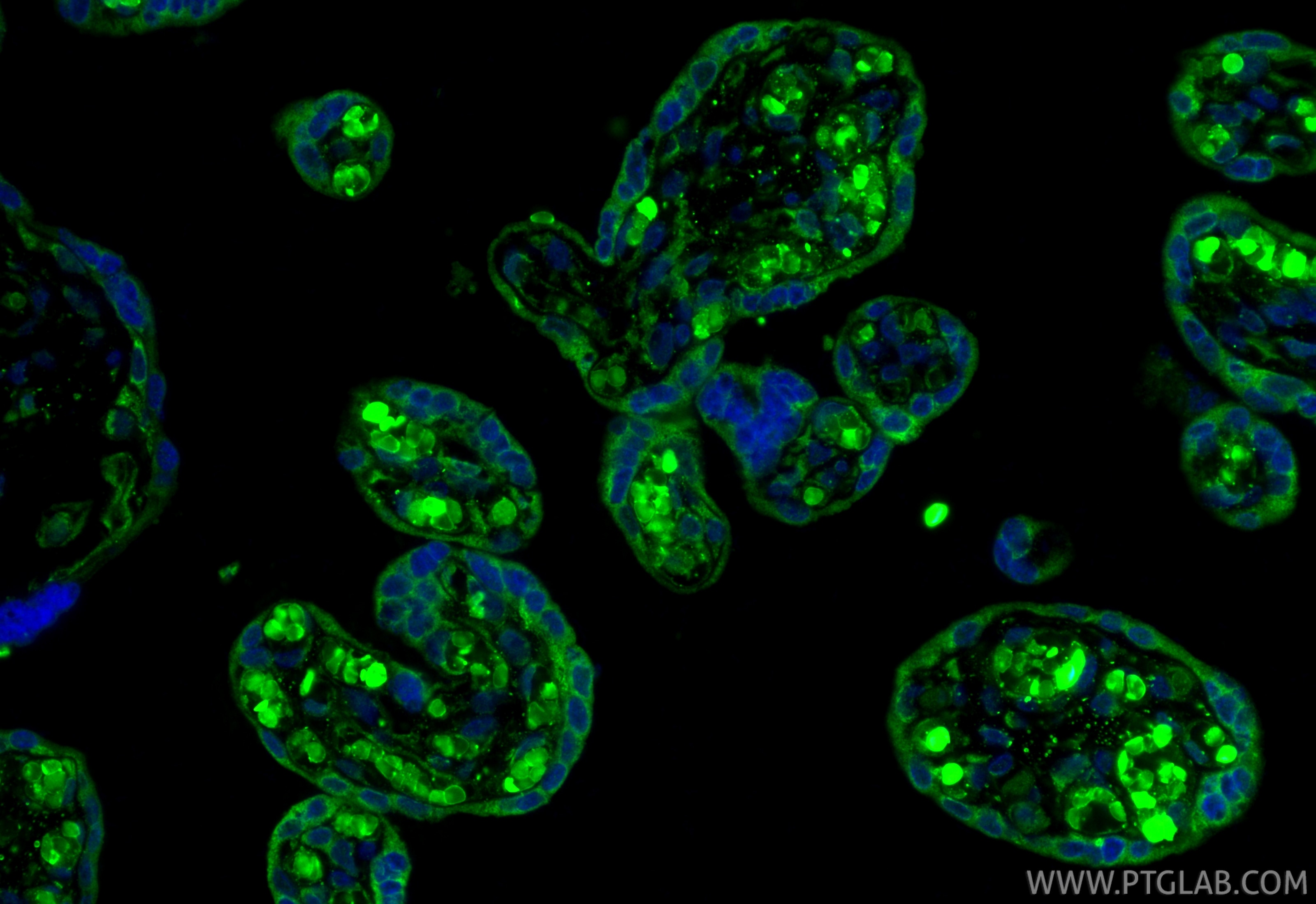 IF Staining of human placenta using 10642-1-AP Immunofluorescence (IF) / fluorescent staining of human placenta tissue using PGF/PLGF Polyclonal antibody (10642-1-AP)