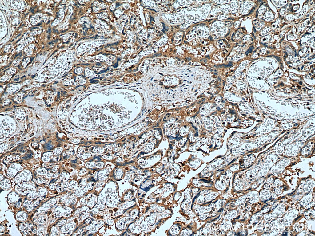 Immunohistochemistry (IHC) staining of human placenta tissue using Placental Growth Factor Polyclonal antibody (10642-1-AP)