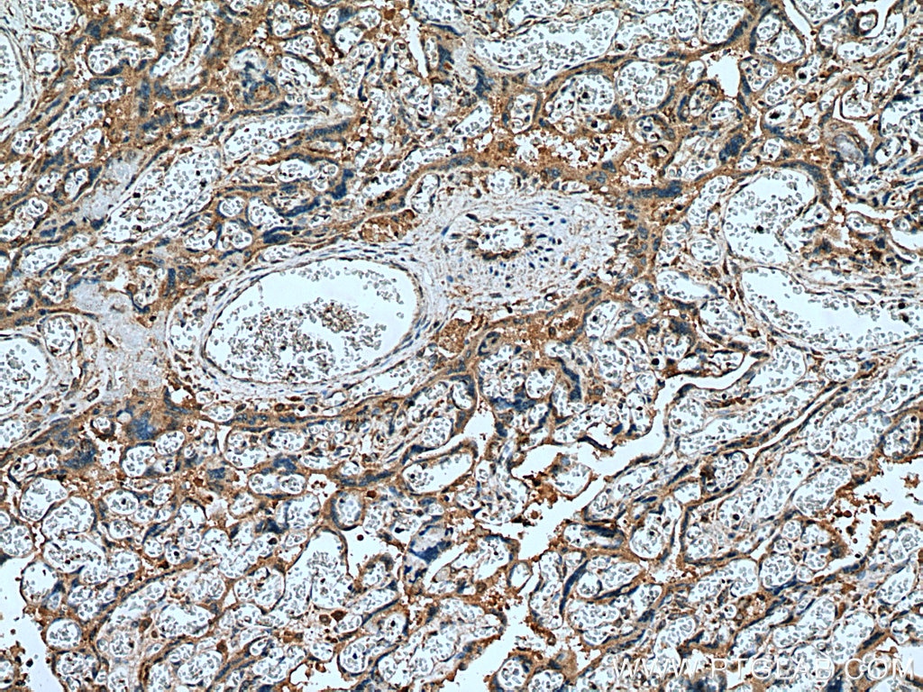 IHC staining of human placenta using 10642-1-AP