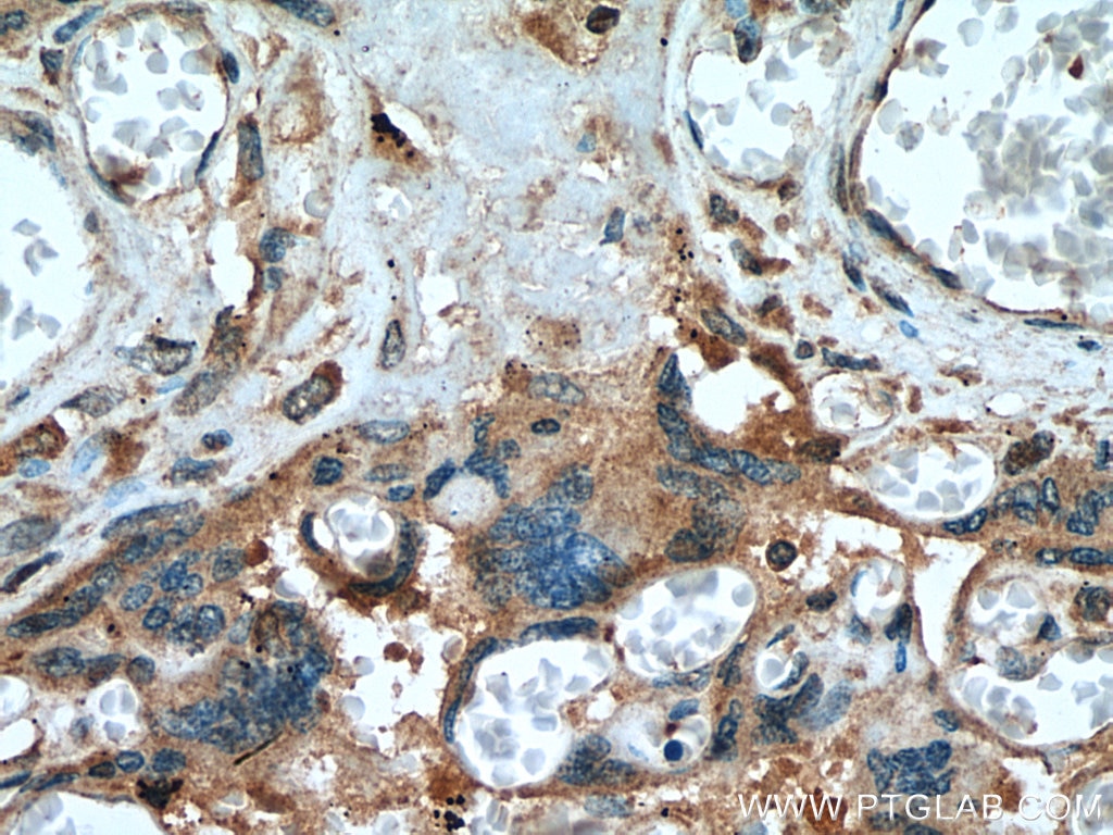 Immunohistochemistry (IHC) staining of human placenta tissue using Placental Growth Factor Polyclonal antibody (10642-1-AP)