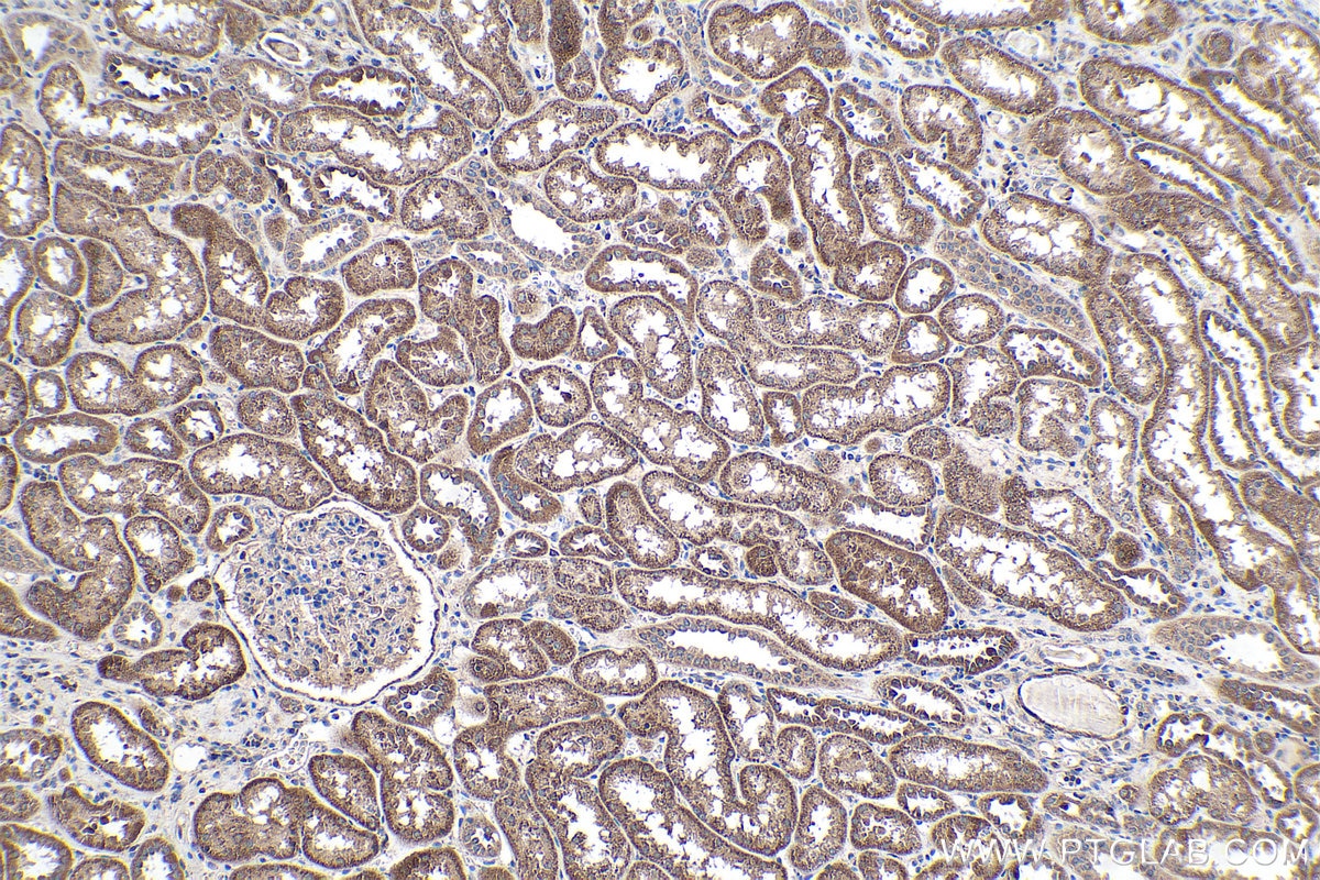 Immunohistochemistry (IHC) staining of human kidney tissue using Placental Growth Factor Polyclonal antibody (10642-1-AP)