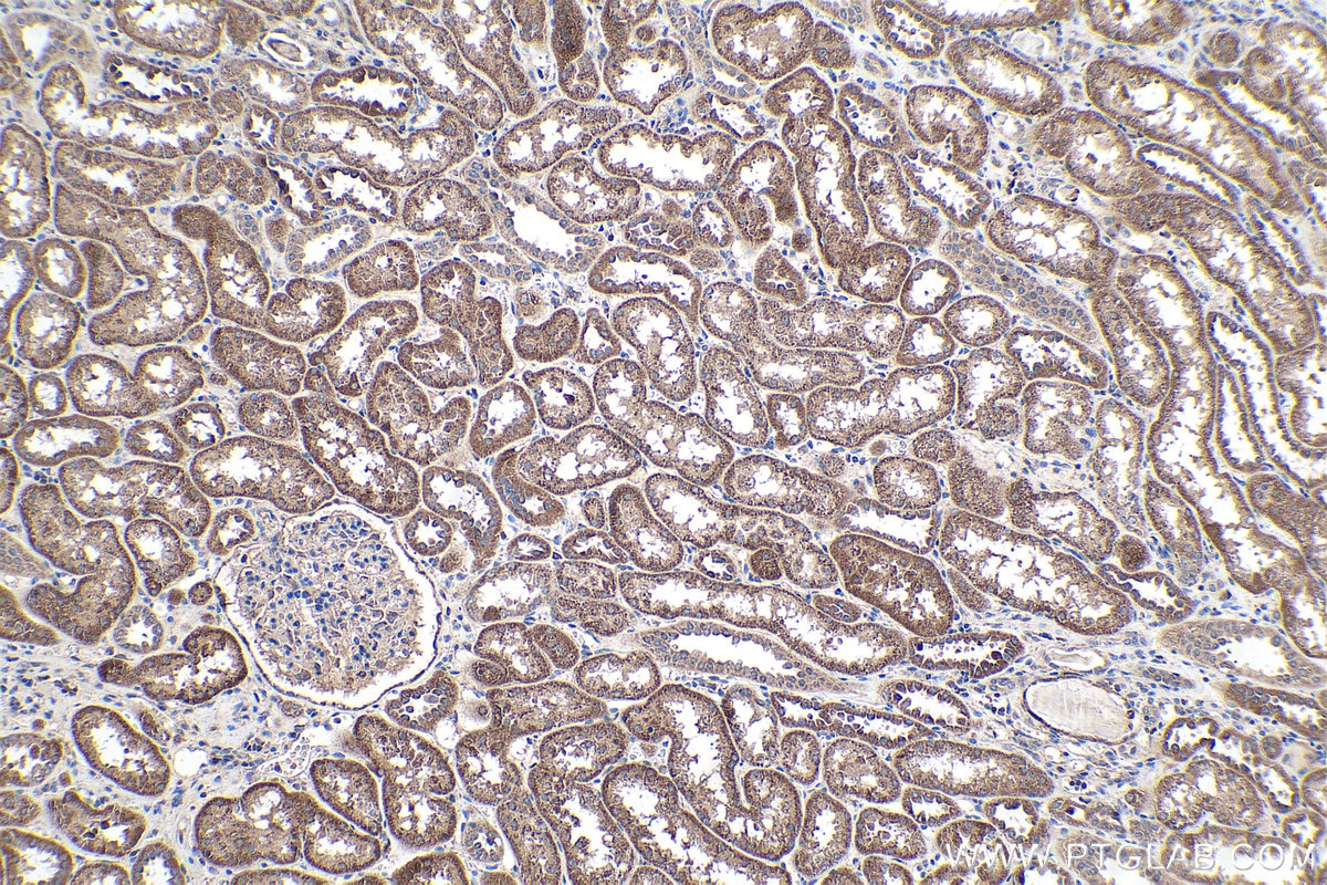 IHC staining of human kidney using 10642-1-AP