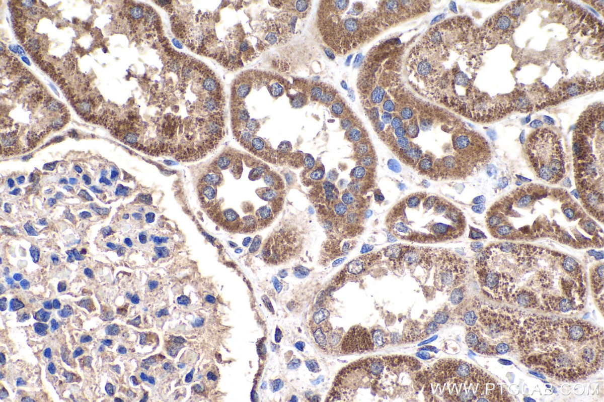 Immunohistochemistry (IHC) staining of human kidney tissue using Placental Growth Factor Polyclonal antibody (10642-1-AP)