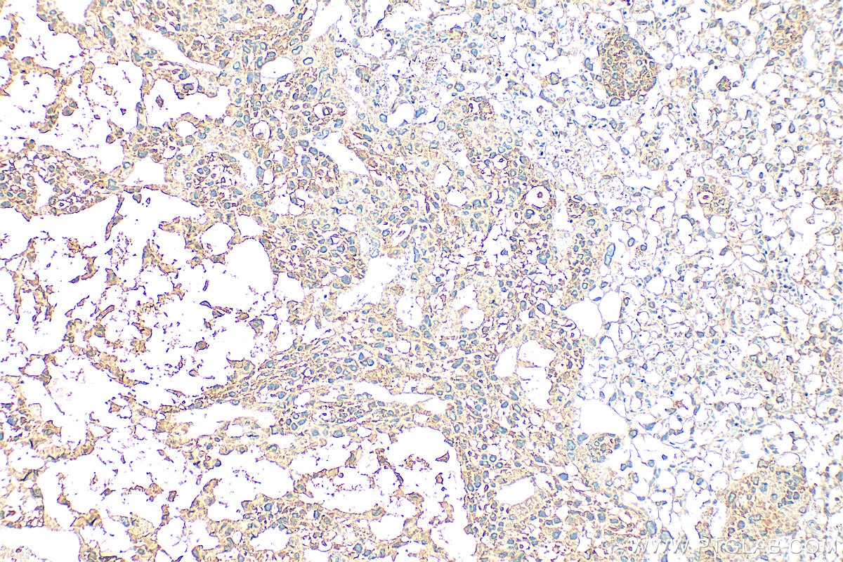 IHC staining of mouse placenta using 10642-1-AP Immunohistochemistry (IHC) staining of mouse placenta tissue using PGF/PLGF Polyclonal antibody (10642-1-AP)