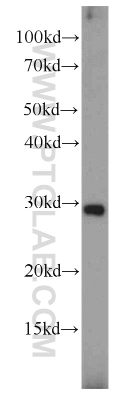 Placental Growth Factor Polyclonal antibody