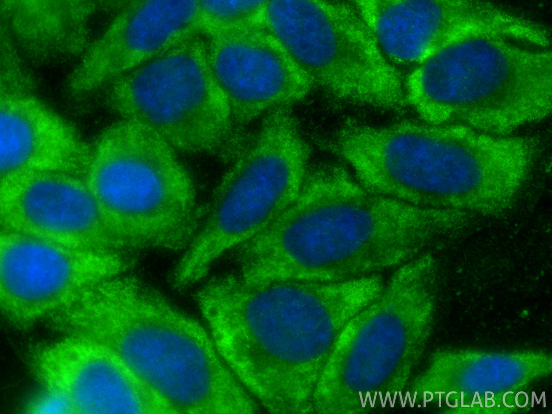 Immunofluorescence (IF) / fluorescent staining of HepG2 cells using PGK1 Polyclonal antibody (17811-1-AP)