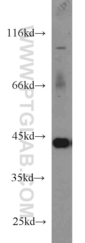 Western Blot (WB) analysis of HEK-293 cells using PGK1 Polyclonal antibody (17811-1-AP)