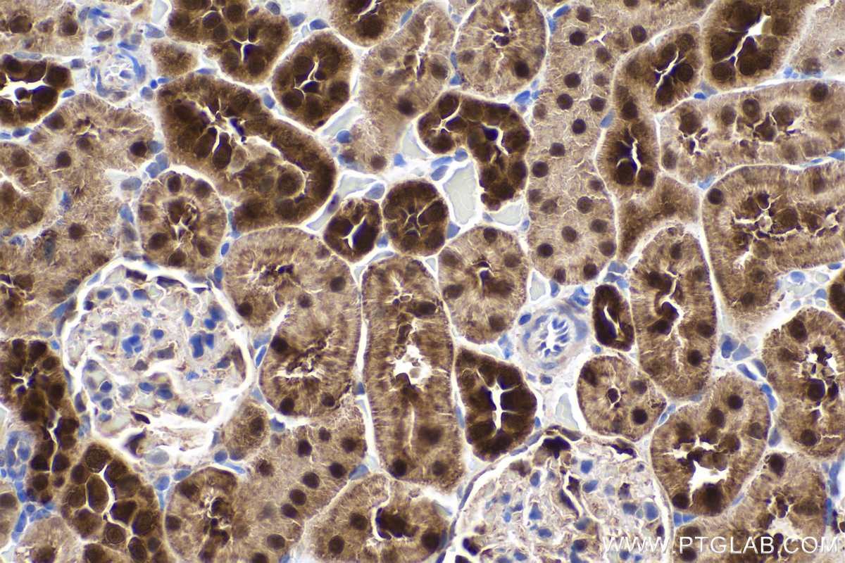 Immunohistochemistry (IHC) staining of rat kidney tissue using PGK1 Monoclonal antibody (68035-1-Ig)