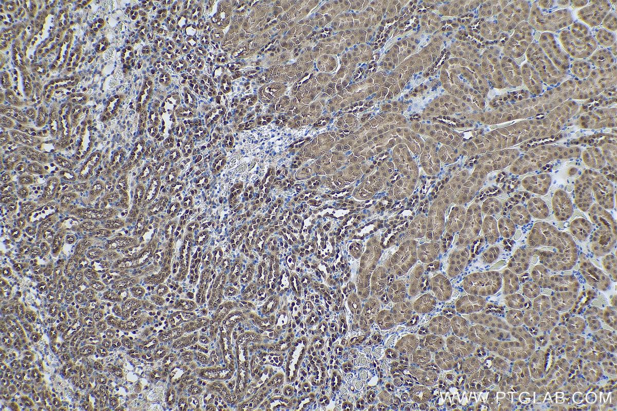 Immunohistochemistry (IHC) staining of mouse kidney tissue using PGK1 Monoclonal antibody (68035-1-Ig)
