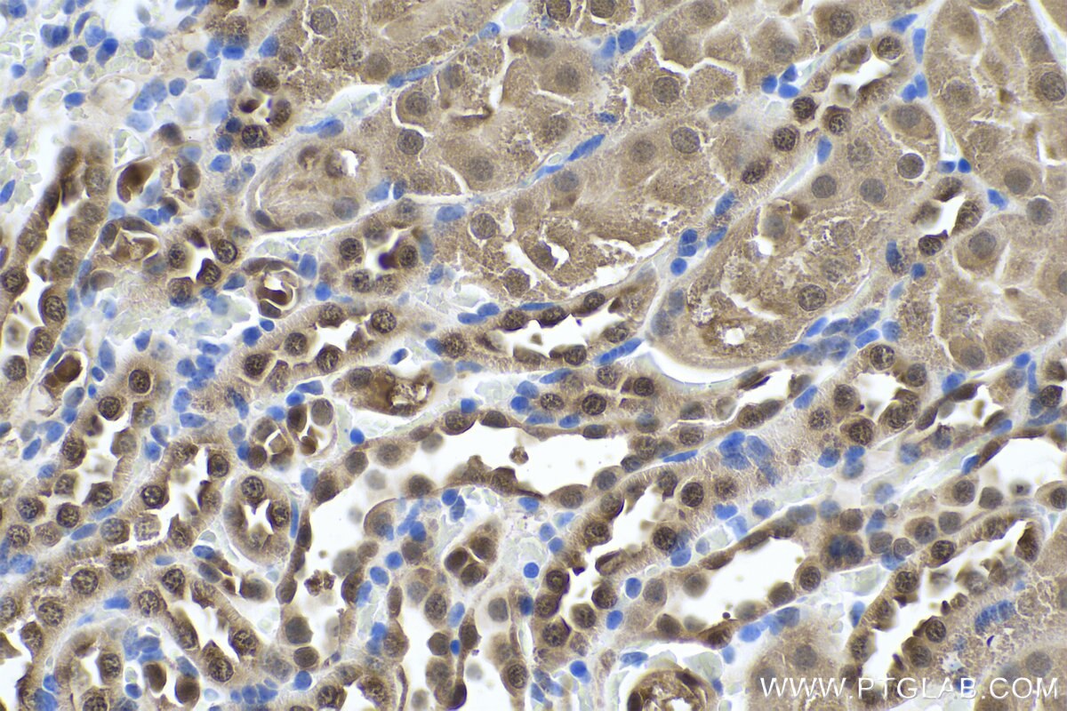 IHC staining of mouse kidney using 68035-1-Ig