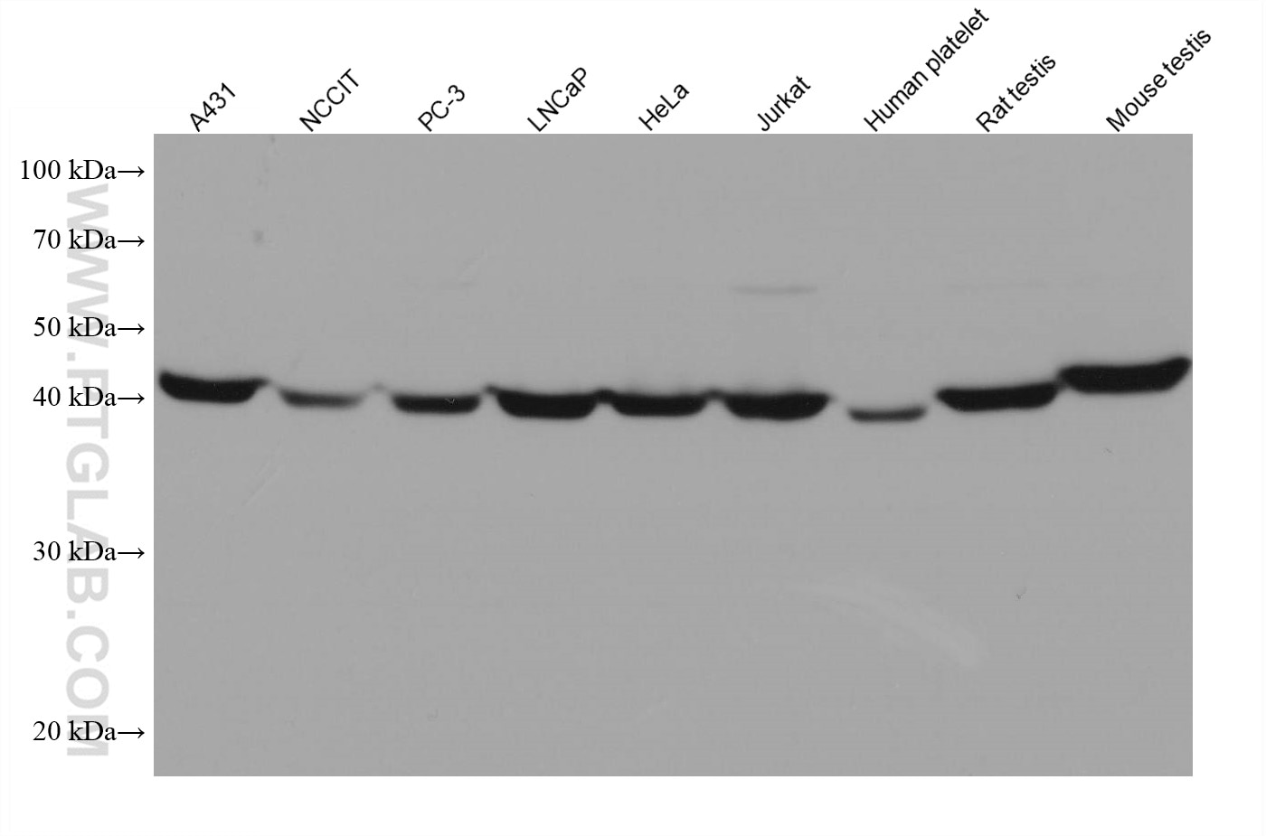 Western Blot (WB) analysis of various lysates using PGK1 Monoclonal antibody (68035-1-Ig)
