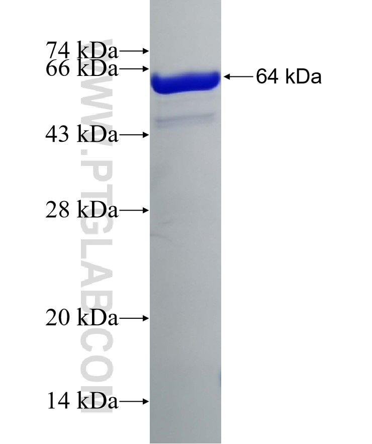PGK1 fusion protein Ag12119 SDS-PAGE