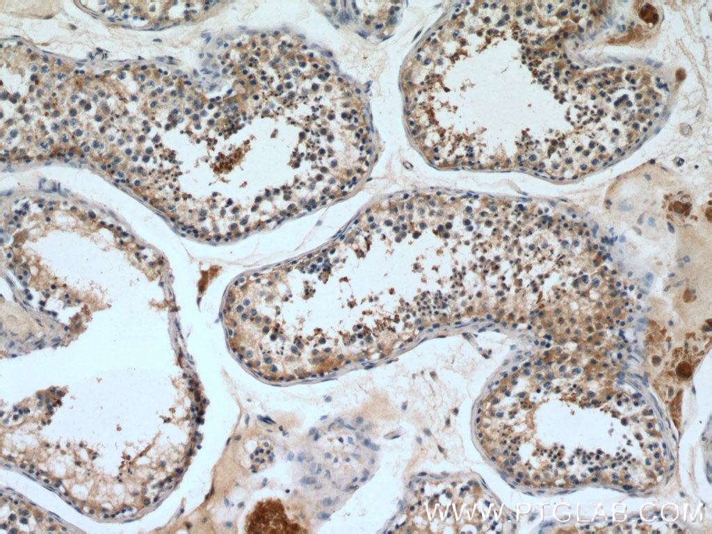 IHC staining of human testis using 13686-1-AP