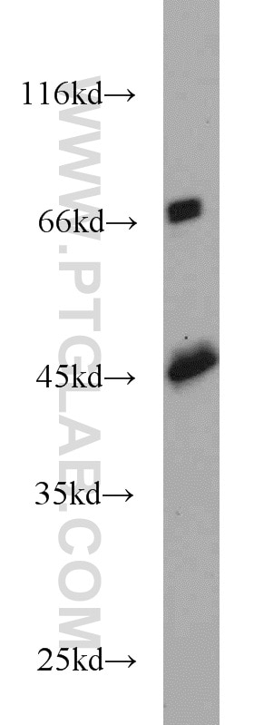 Western Blot (WB) analysis of human heart tissue using PGK2 Polyclonal antibody (13686-1-AP)