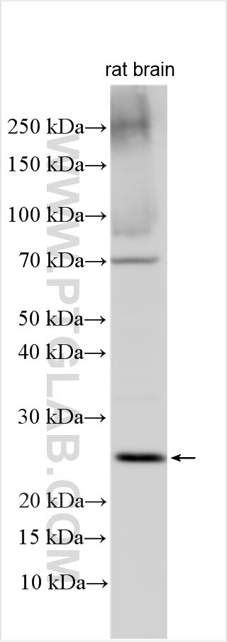 Western Blot (WB) analysis of various lysates using PGLYRP1 Polyclonal antibody (18046-1-AP)