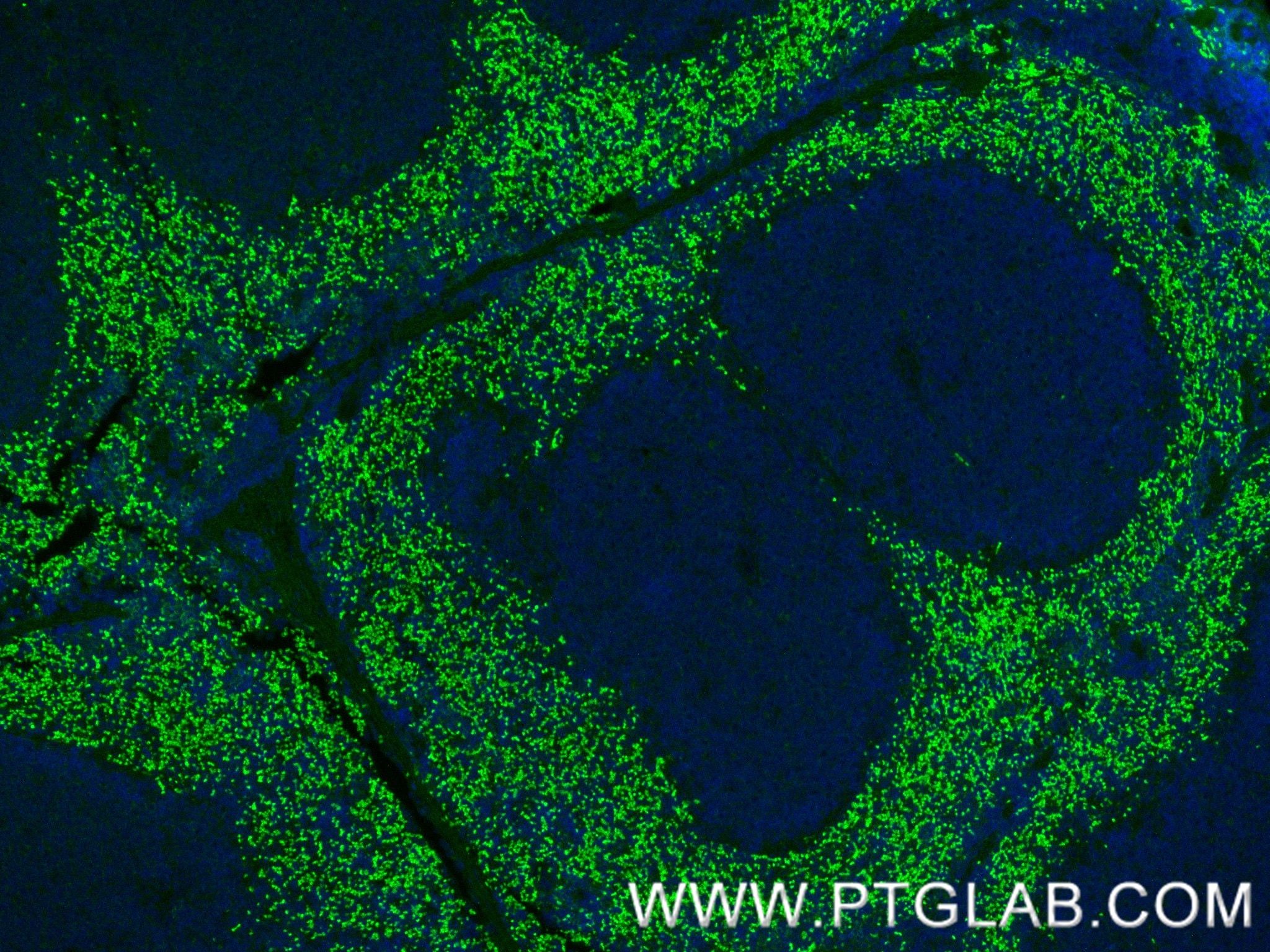 Immunofluorescence (IF) / fluorescent staining of mouse spleen tissue using PGLYRP1 Recombinant antibody (85610-4-RR)
