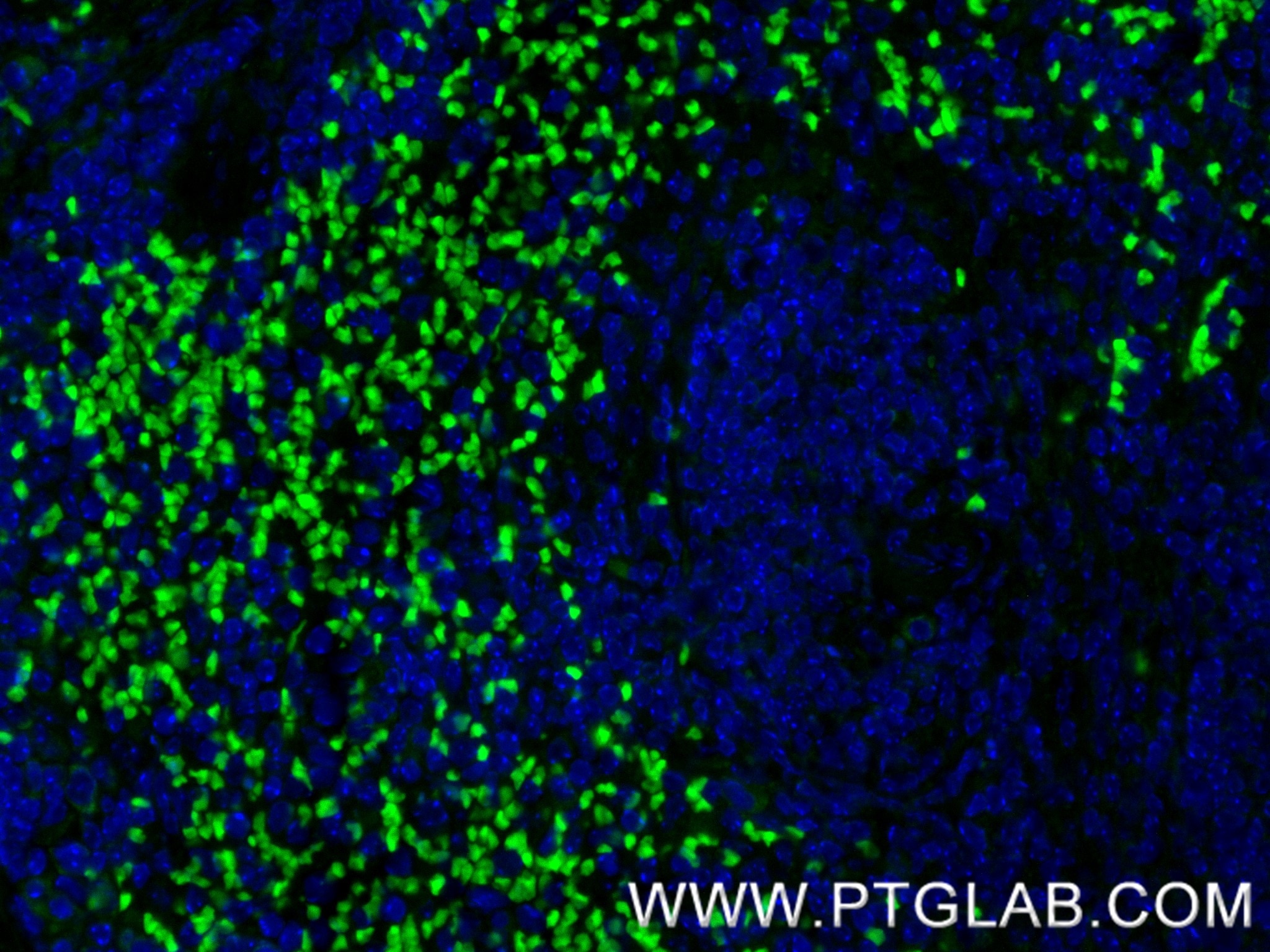 Immunofluorescence (IF) / fluorescent staining of mouse spleen tissue using PGLYRP1 Recombinant antibody (85610-4-RR)