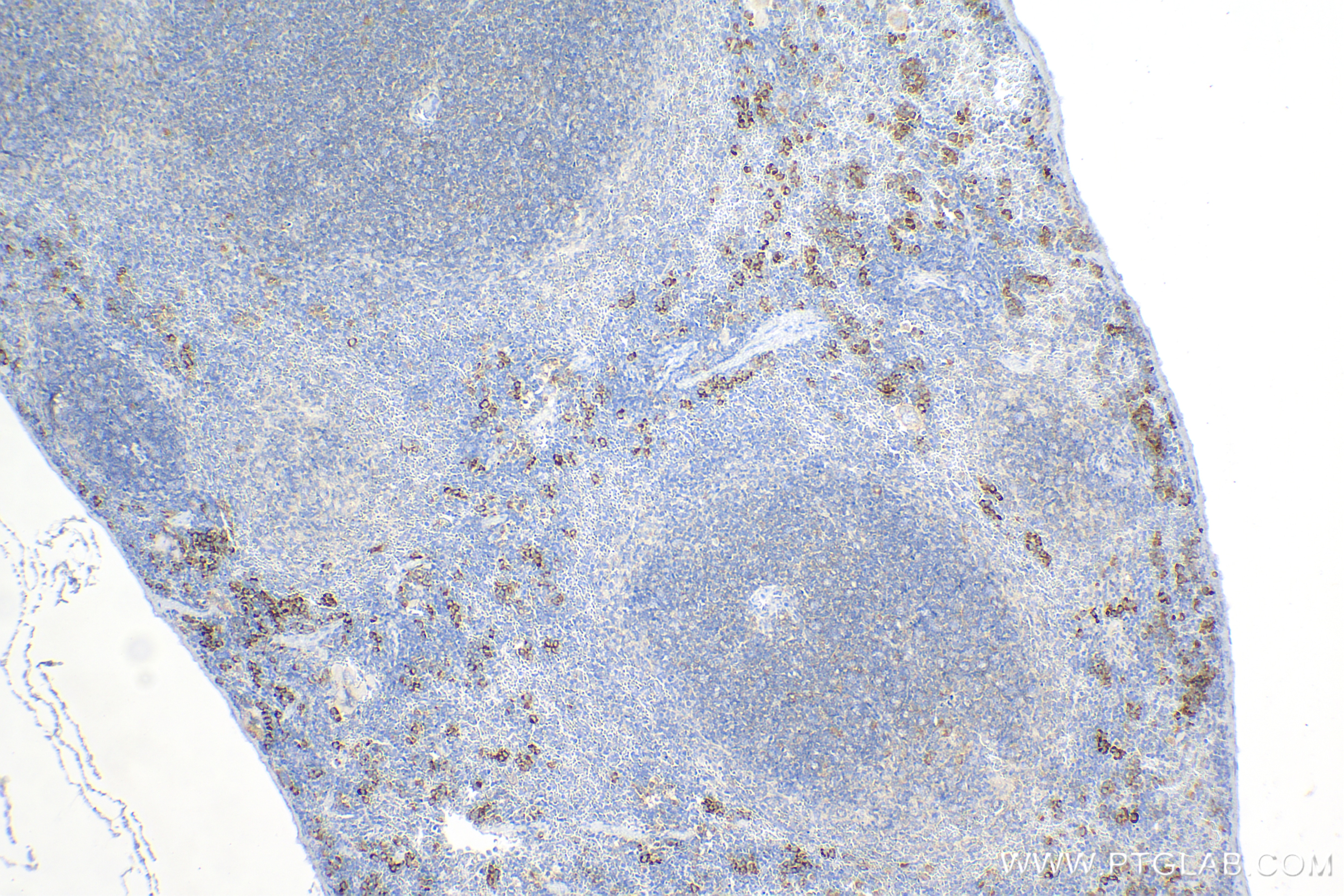 Immunohistochemistry (IHC) staining of mouse spleen tissue using PGLYRP1 Recombinant antibody (85610-4-RR)