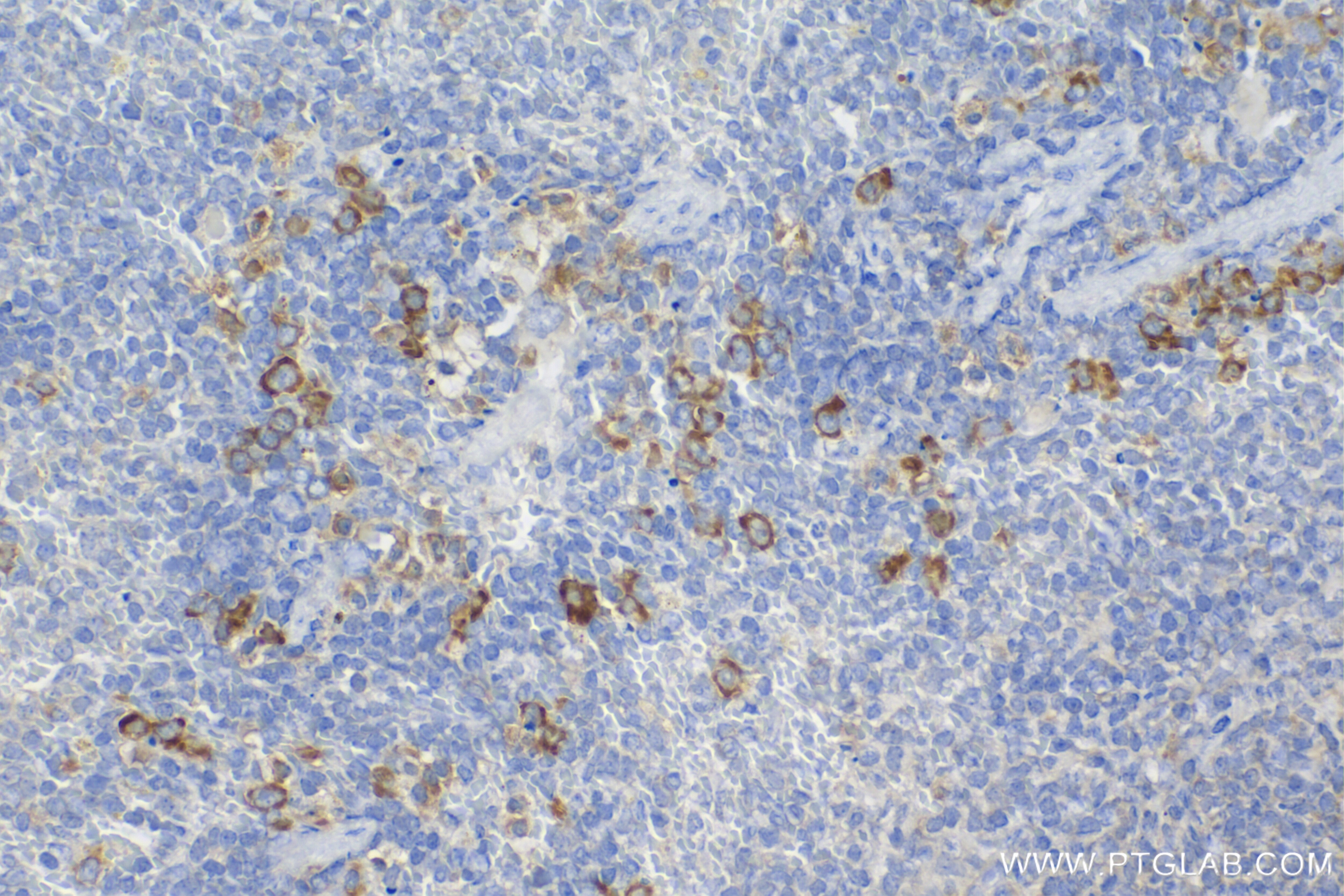 Immunohistochemistry (IHC) staining of mouse spleen tissue using PGLYRP1 Recombinant antibody (85610-4-RR)