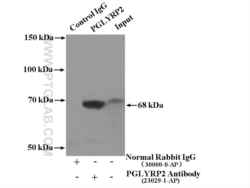 IP experiment of human plasma using 23029-1-AP