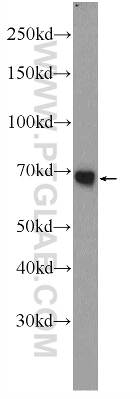 Western Blot (WB) analysis of human plasma using PGLYRP2 Polyclonal antibody (23029-1-AP)