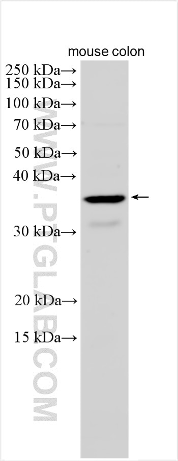 Western Blot (WB) analysis of various lysates using PGLYRP3 Polyclonal antibody (18082-1-AP)