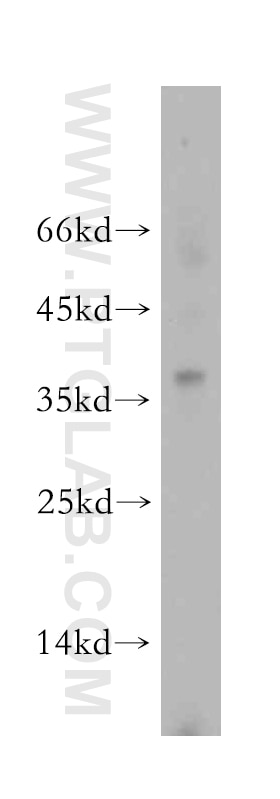 Western Blot (WB) analysis of Apoptosised HeLa cells using PGLYRP3 Polyclonal antibody (18082-1-AP)