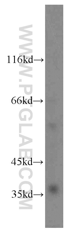 Western Blot (WB) analysis of mouse brain tissue using PGLYRP3 Polyclonal antibody (18082-1-AP)