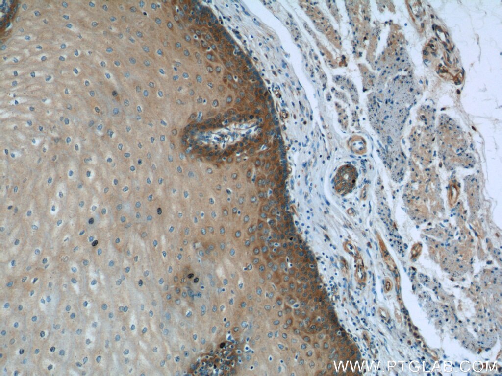 Immunohistochemistry (IHC) staining of human oesophagus tissue using PGLYRP4 Polyclonal antibody (21134-1-AP)