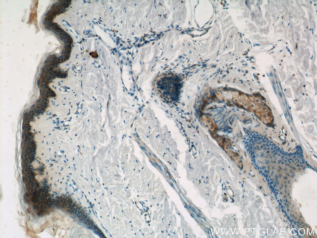 Immunohistochemistry (IHC) staining of human skin tissue using PGLYRP4 Polyclonal antibody (21134-1-AP)