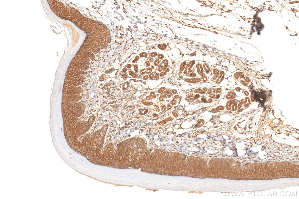 Immunohistochemistry (IHC) staining of mouse skin tissue using PGLYRP4 Polyclonal antibody (21134-1-AP)