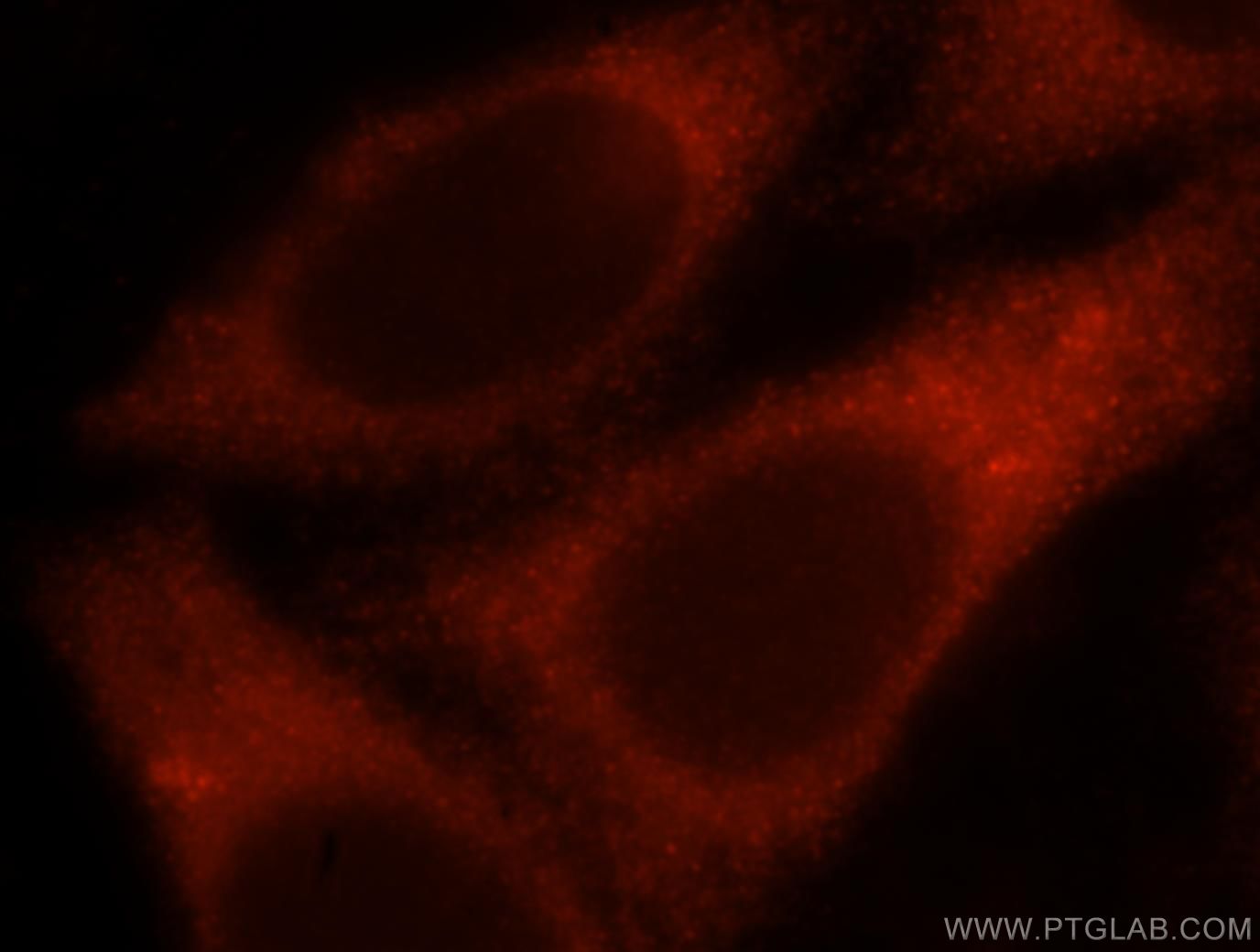 Immunofluorescence (IF) / fluorescent staining of HepG2 cells using PGM1 Polyclonal antibody (15161-1-AP)