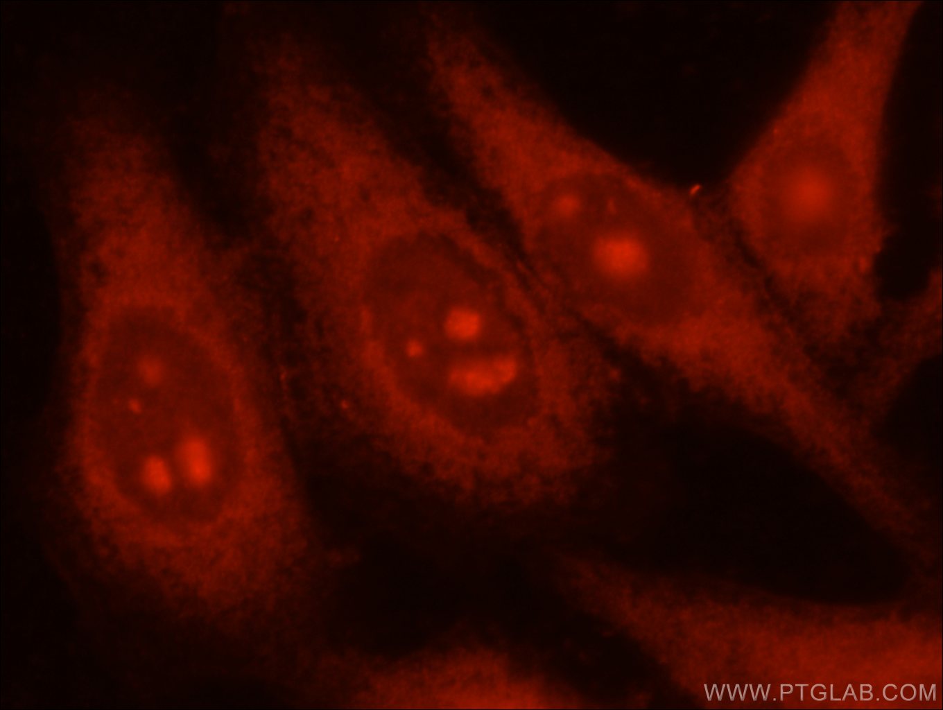 Immunofluorescence (IF) / fluorescent staining of HepG2 cells using PGM1 Polyclonal antibody (15161-1-AP)
