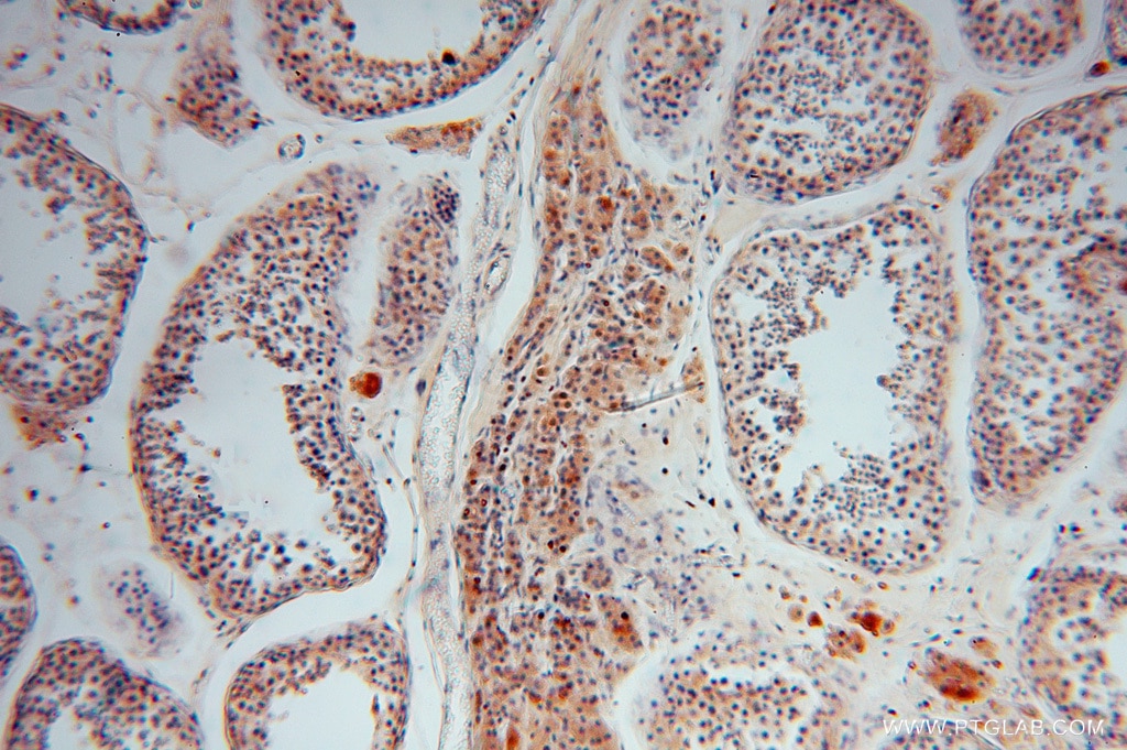 Immunohistochemistry (IHC) staining of human testis tissue using PGM1 Polyclonal antibody (15161-1-AP)