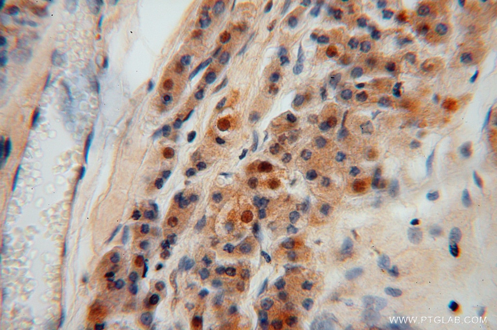 Immunohistochemistry (IHC) staining of human testis tissue using PGM1 Polyclonal antibody (15161-1-AP)