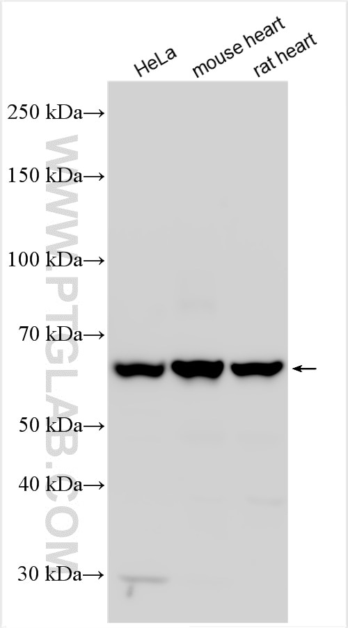 Western Blot (WB) analysis of various lysates using PGM1 Polyclonal antibody (15161-1-AP)
