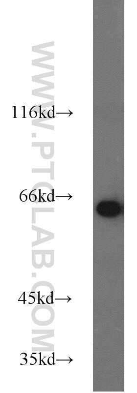 Western Blot (WB) analysis of mouse skin tissue using PGM1 Polyclonal antibody (15161-1-AP)