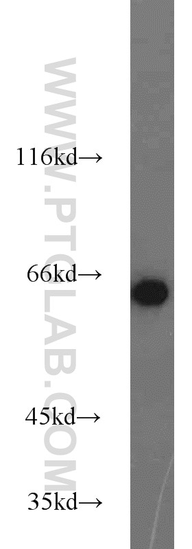 Western Blot (WB) analysis of mouse skin tissue using PGM1 Polyclonal antibody (15161-1-AP)