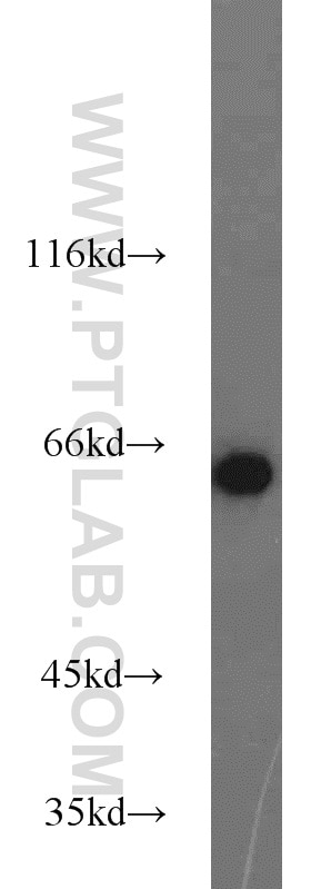 WB analysis of mouse skin using 15161-1-AP