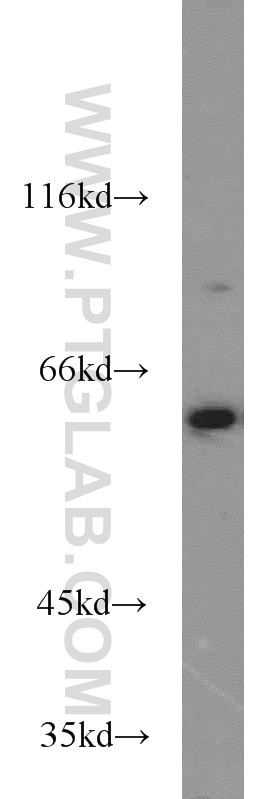 Western Blot (WB) analysis of HEK-293 cells using PGM1 Polyclonal antibody (15161-1-AP)