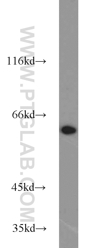 Western Blot (WB) analysis of HEK-293 cells using PGM1 Polyclonal antibody (15161-1-AP)