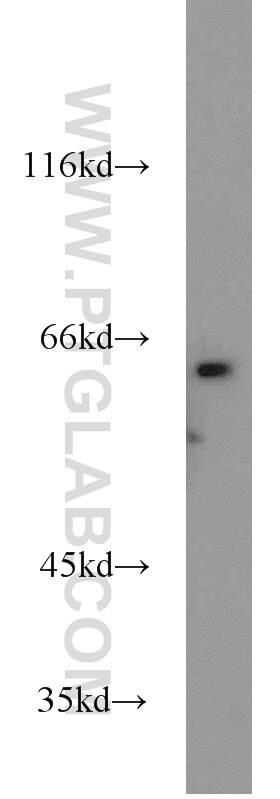 Western Blot (WB) analysis of HeLa cells using PGM1 Polyclonal antibody (15161-1-AP)